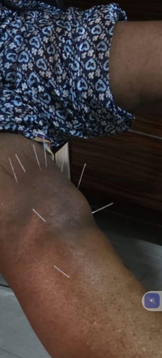 Knee Arthritis Treatment